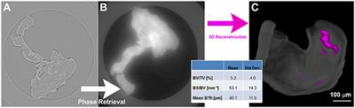 Synchrotron Phase Tomography: An Emerging Imaging Method for Microvessel Detection in Engineered Bone of Craniofacial Districts